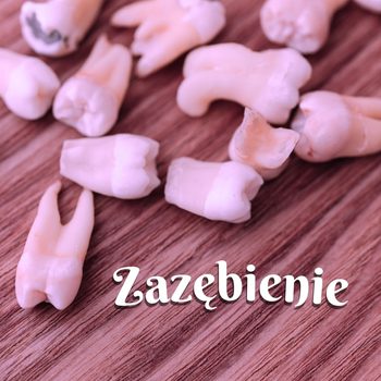 zazębienie opowiadanie